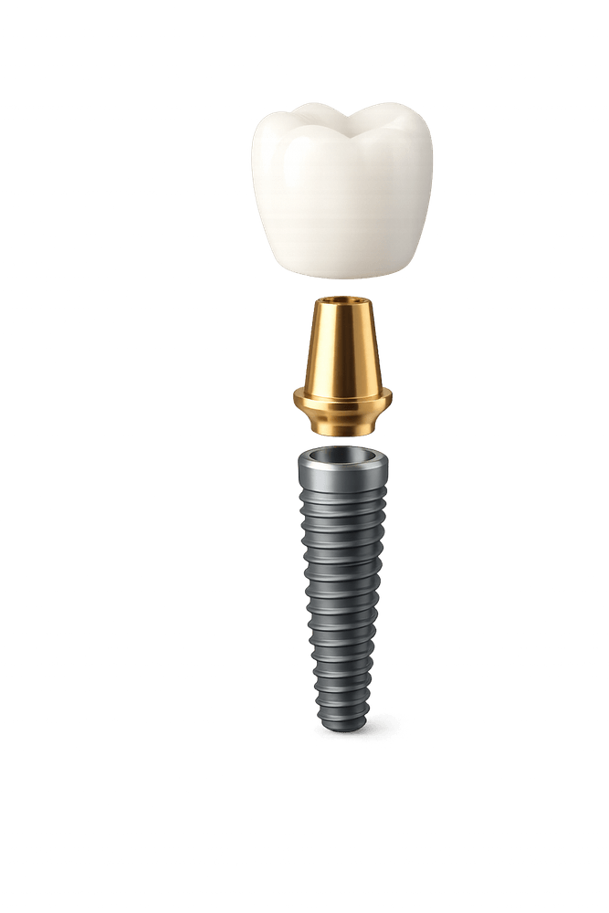 İmplant, abutment ve kron